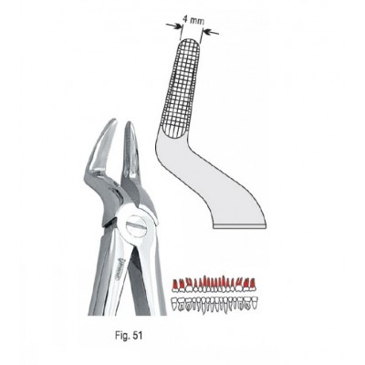 Щипцы экстракционные для верхних корней (DЕ.800.511)